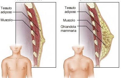 Interventi di Ginecomastia